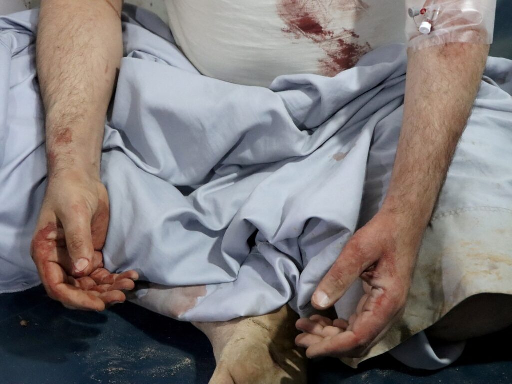 ‘Just like that’: Yemeni households destroyed by US air strikes | Israel-Palestine battle News | USAEMALL.com