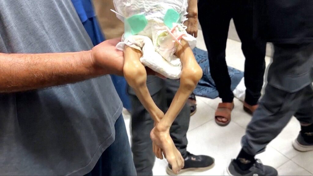 What has Israel’s denial of meals accomplished to Gaza’s folks? | Israel-Palestine battle | USAEMALL.com