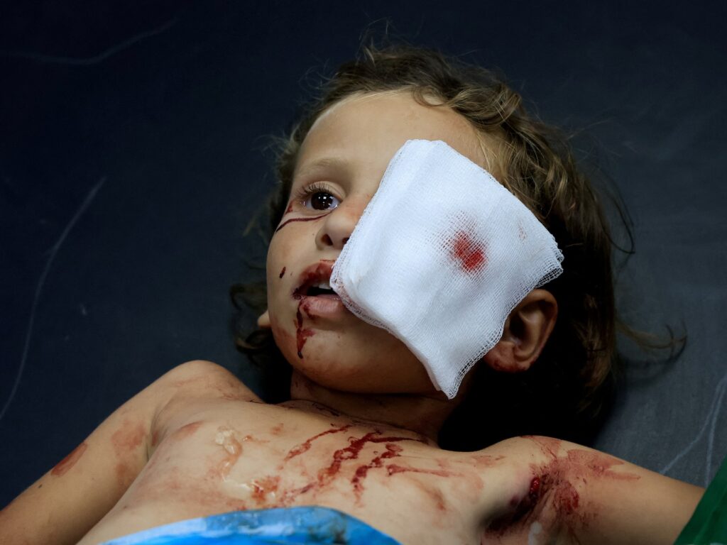 I used to be coaching to heal eyes in Gaza. Then every thing went darkish | Israel-Palestine battle | USAEMALL.com