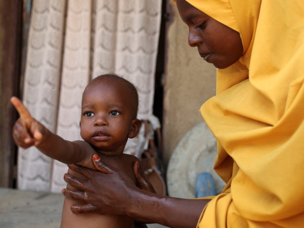 Millions of kids in danger throughout Africa as help cuts impression meals provides | Child Rights News | USAEMALL.com