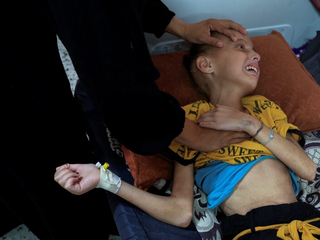 Tens of hundreds of Palestinian kids ravenous in Gaza tent camps | Israel-Palestine battle News | USAEMALL.com