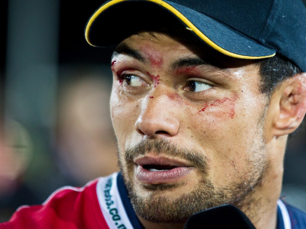 New Zealand rugby participant who referred to as for research of concussions dies at 39 | Rugby News | USAEMALL.com