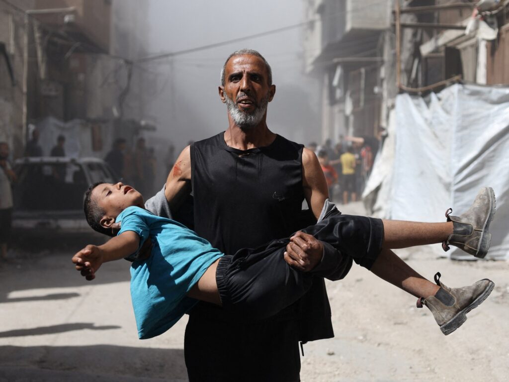 Foreign docs say Israel systematically concentrating on Gaza’s kids: Report | Israel-Palestine battle News | USAEMALL.com