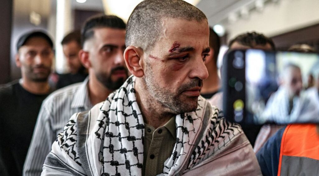 What’s subsequent for launched Palestinian prisoners? | Israel-Palestine battle | USAEMALL.com