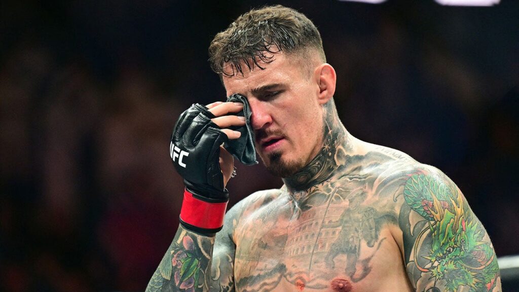 Tom Aspinall cannot proceed after Ciryl Gane pokes each eyes in UFC foremost occasion | USAEMALL.com