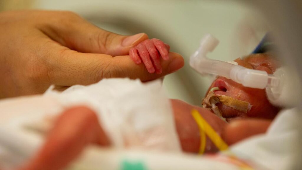 King Edward Memorial Hospital examine utilizing cutting-edge tech to rework care of preterm infants’ pores and skin | USAEMALL.com