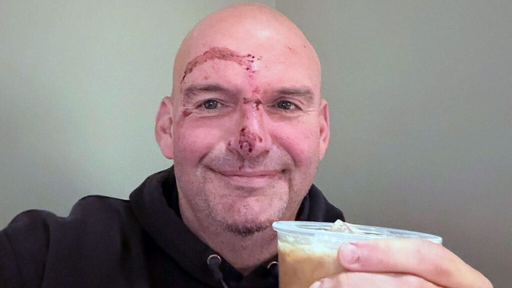 Sen. John Fetterman shares restoration picture after coronary heart hospitalization | USAEMALL.com