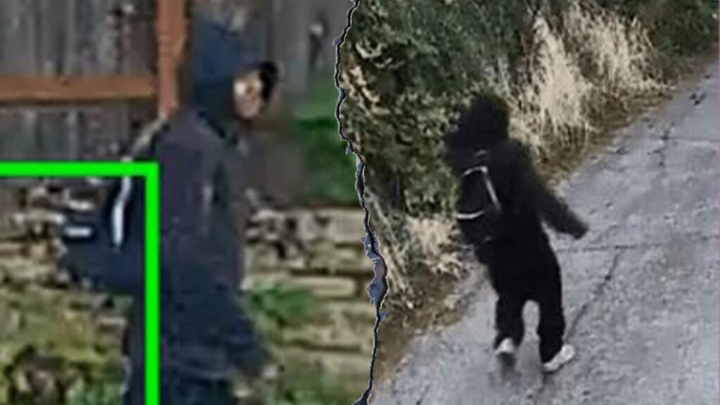 88-year-old girl hospitalized after finger bitten off in theft: police | USAEMALL.com