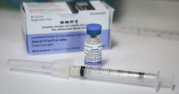 Quebec stories three measles instances linked to Montreal-area pediatric centre – Montreal | USAEMALL.com