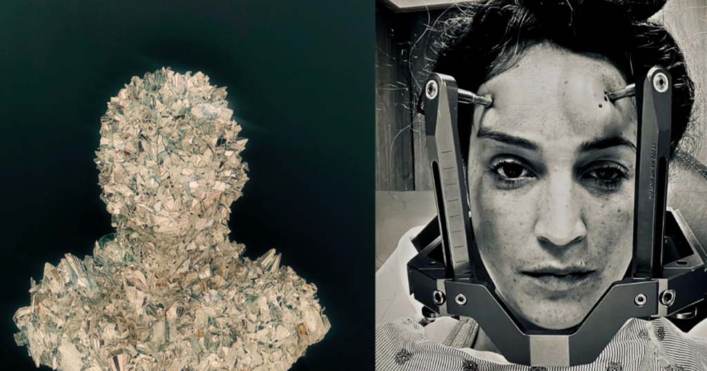 No one knew what was unsuitable together with her — till an MRI discovered incurable illness. She turned her harrowing journey into distinctive artwork. | USAEMALL.com