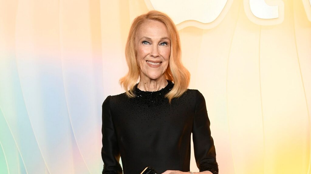 Catherine O’Hara had uncommon medical situation earlier than her dying at 71 | USAEMALL.com