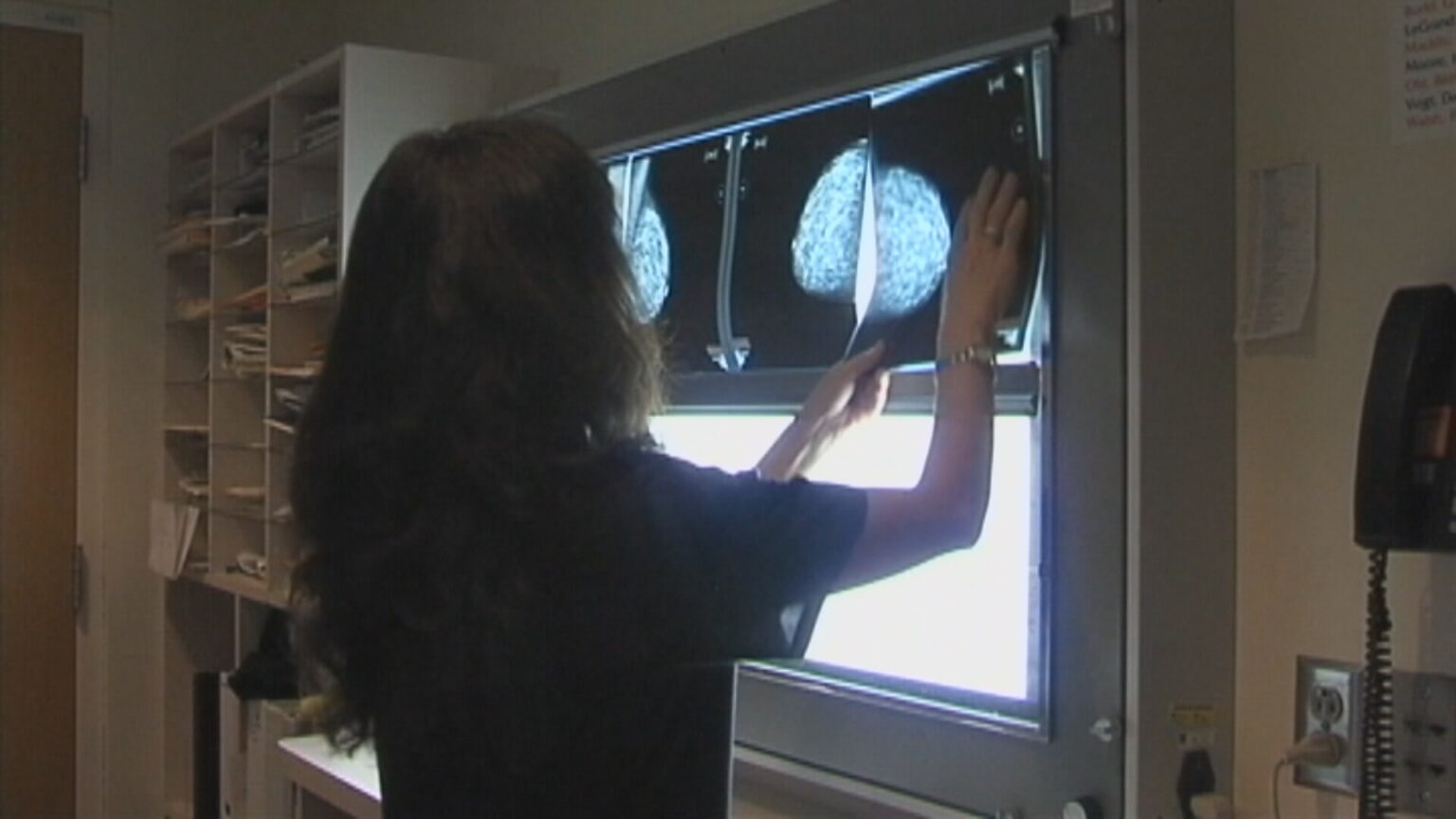 Breast most cancers initiative sending sufferers to Alberta is decreasing Sask. wait listing | USAEMALL.com